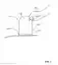 Fig. 02 - Hair removal system with light source array