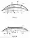 Fig. 14 - Methods and devices for ablation