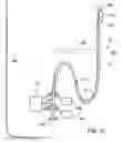 Fig. 17 - Methods and devices for ablation