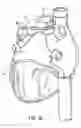 Fig. 19 - Methods and devices for ablation