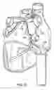 Fig. 22 - Methods and devices for ablation