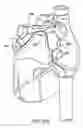 Fig. 25 - Methods and devices for ablation