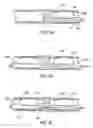 Fig. 31 - Methods and devices for ablation