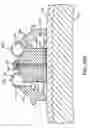 Fig. 41 - Methods and devices for ablation