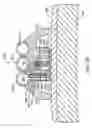 Fig. 43 - Methods and devices for ablation