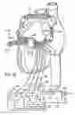 Fig. 44 - Methods and devices for ablation