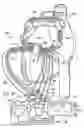 Fig. 45 - Methods and devices for ablation