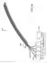 Fig. 46 - Methods and devices for ablation