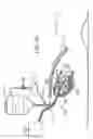 Fig. 60 - Methods and devices for ablation