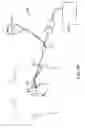 Fig. 72 - Methods and devices for ablation