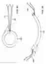 Fig. 75 - Methods and devices for ablation