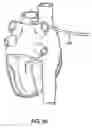 Fig. 76 - Methods and devices for ablation