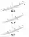 Fig. 02 - Implants and methods for positioning same in surgical approaches to the spine