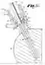 Fig. 05 - Bone attachment structure with engagement projections