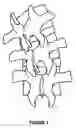 Fig. 02 - Method and device for treating ailments of the spine