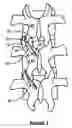 Fig. 03 - Method and device for treating ailments of the spine
