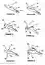 Fig. 04 - Method and device for treating ailments of the spine