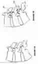Fig. 08 - Method and device for treating ailments of the spine