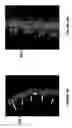 Fig. 09 - Method and device for treating ailments of the spine