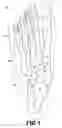 Fig. 02 - Hindfoot nail
