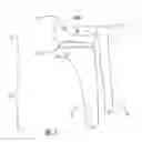 Fig. 02 - Intramedullary interlocking fixation devices for the distal radius