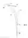 Fig. 09 - Intramedullary interlocking fixation devices for the distal radius