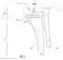 Fig. 02 - Intramedullary interlocking fixation devices for the distal radius
