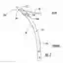 Fig. 08 - Intramedullary interlocking fixation devices for the distal radius