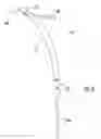 Fig. 09 - Intramedullary interlocking fixation devices for the distal radius