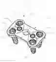 Fig. 01 - Spinal plate with screw locks and cam locks