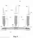 Fig. 03 - Orthopedic plate system and method for using the same