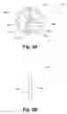 Fig. 06 - Orthopedic plate system and method for using the same
