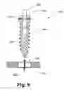 Fig. 10 - Orthopedic plate system and method for using the same