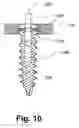 Fig. 11 - Orthopedic plate system and method for using the same