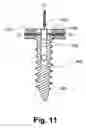Fig. 12 - Orthopedic plate system and method for using the same