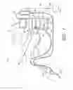 Fig. 02 - Surgical file system with fluid system