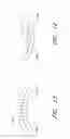 Fig. 13 - Surgical file system with fluid system
