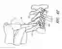 Fig. 40 - Surgical file system with fluid system