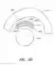 Fig. 84 - Surgical file system with fluid system