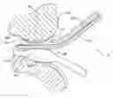 Fig. 01 - Surgical file instrument