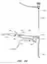 Fig. 45 - Surgical file instrument
