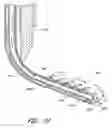 Fig. 49 - Surgical file instrument