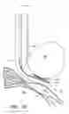 Fig. 52 - Surgical file instrument