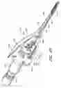 Fig. 60 - Surgical file instrument