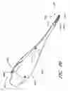 Fig. 67 - Surgical file instrument