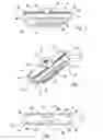 Fig. 02 - Apparatuses and methods for arthroplastic surgery