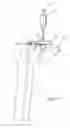 Fig. 07 - Apparatuses and methods for arthroplastic surgery