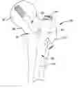 Fig. 01 - Internal fixation assemblies and associated instruments