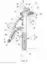 Fig. 03 - Total knee arthroplasty instruments