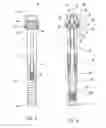 Fig. 04 - Total knee arthroplasty instruments